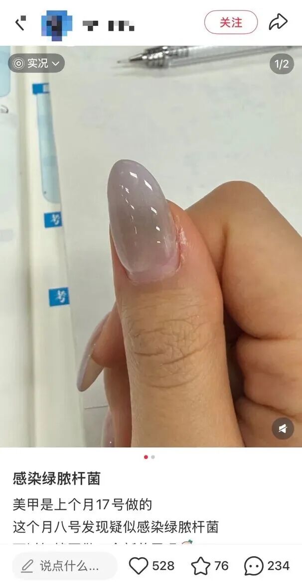 做美甲染上传染病？夏天做足部美甲前必看这些风险(图1)