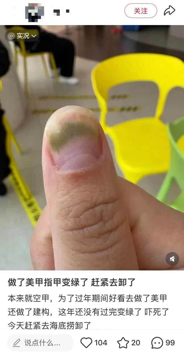 做美甲染上传染病？夏天做足部美甲前必看这些风险(图2)