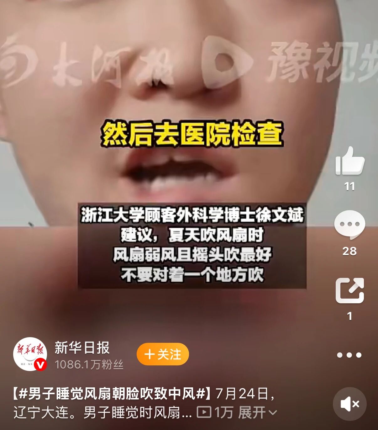 知名艺人患面瘫引关注，一文带你了解面瘫是什么(图2)