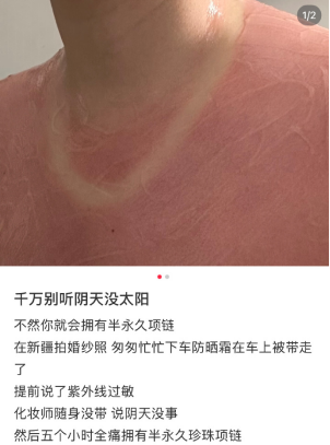 阴天不防晒更易晒伤?UVA穿透云层悄悄让你变黑(图1) 阴天不防晒更易晒伤?UVA穿透云层悄悄让你变黑(图1)