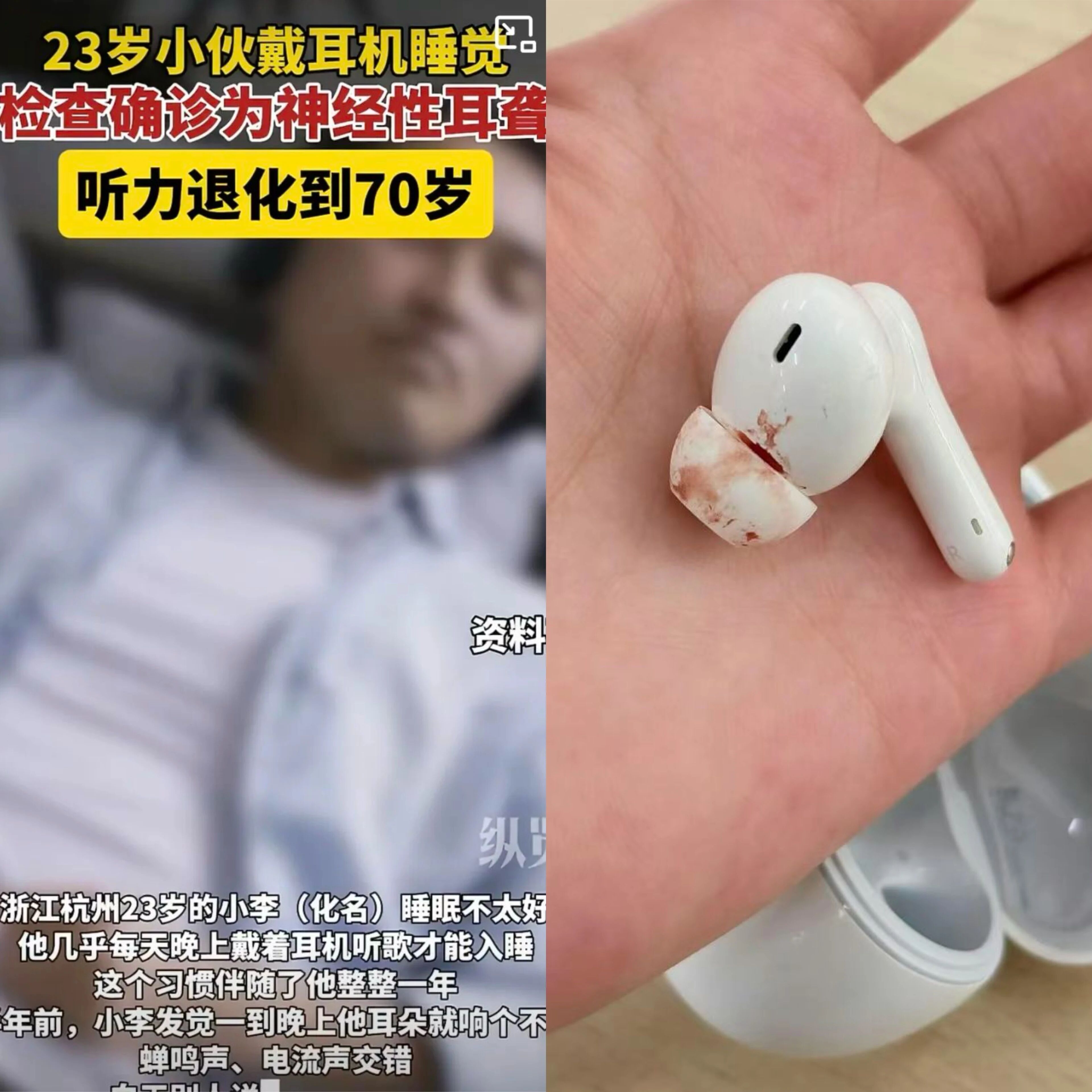 长期戴耳机听力退化,年轻人必知的护耳真相(图1) 长期戴耳机听力退化,年轻人必知的护耳真相(图1)