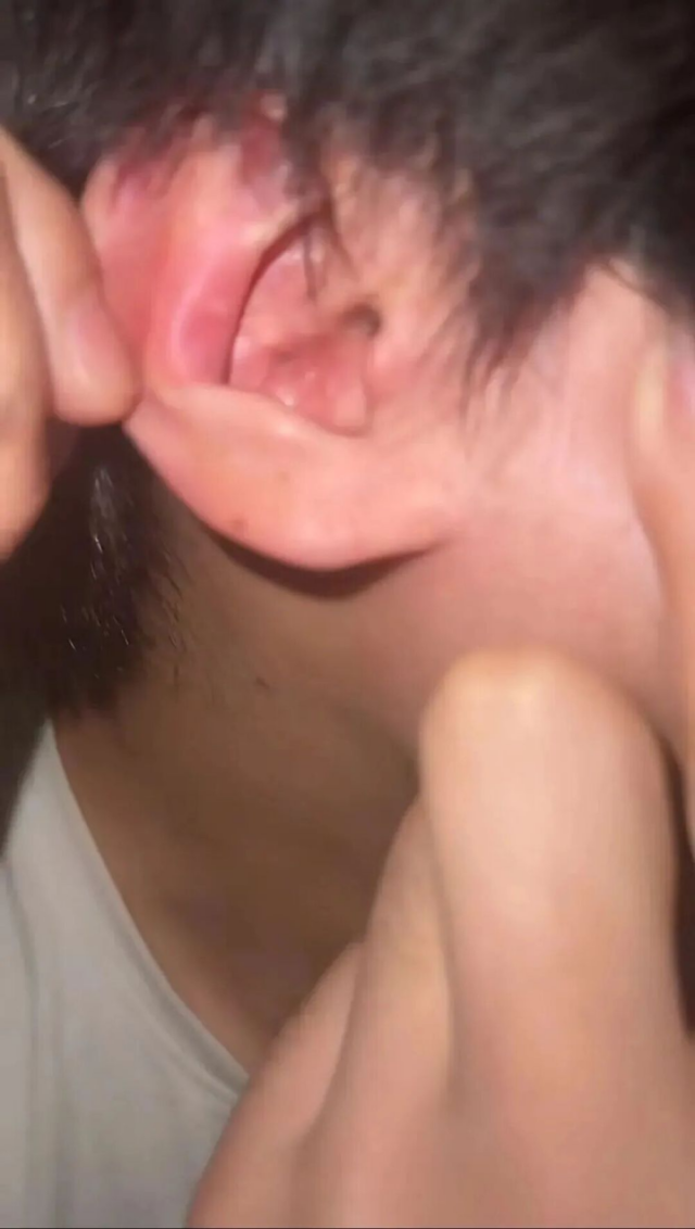 长期戴耳机听力退化,年轻人必知的护耳真相(图6) 长期戴耳机听力退化,年轻人必知的护耳真相(图6)