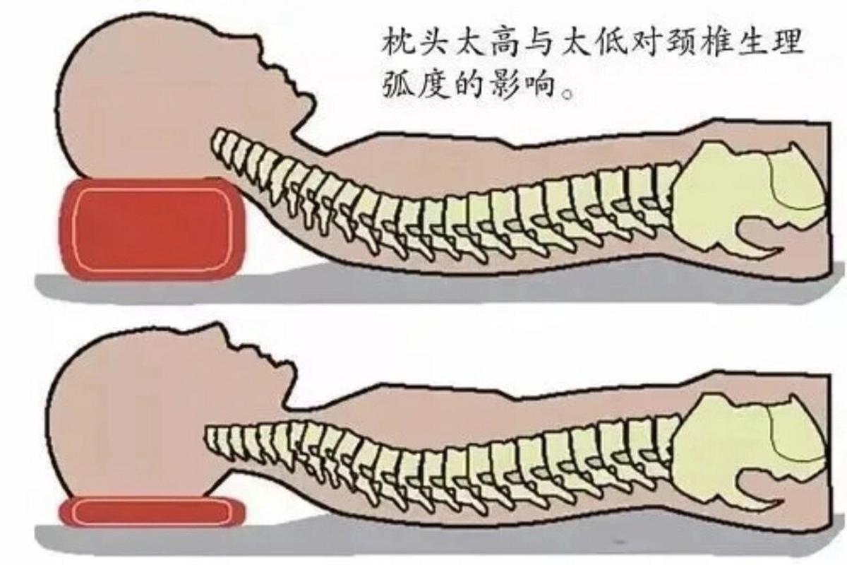睡觉不用枕头行不行？专业建议助你选适合自己的睡眠方式(图1)