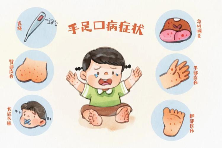 福州手足口病高发！5岁以下孩子家长需警惕防护(图1)