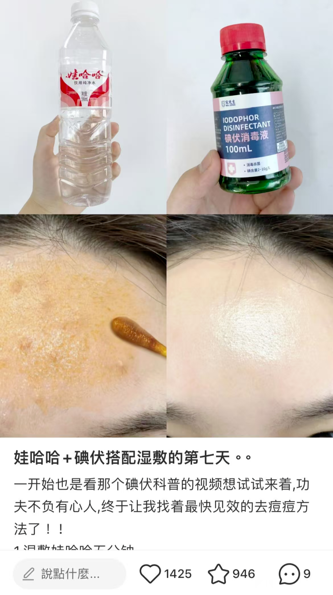 碘伏别乱用!这些神奇功效是假的,别再信了(图2) 碘伏别乱用!这些神奇功效是假的,别再信了(图2)