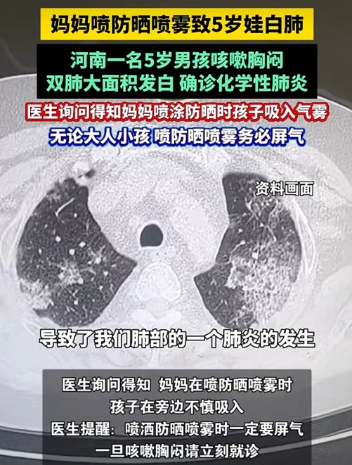 防晒喷雾用错会伤肺!别让孩子近距离吸入(图2) 防晒喷雾用错会伤肺!别让孩子近距离吸入(图2)
