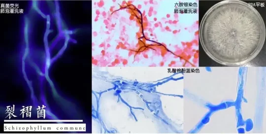 家里地板长霉菌?当心引发肺部感染!夏季防霉必看(图4) 家里地板长霉菌?当心引发肺部感染!夏季防霉必看(图4)