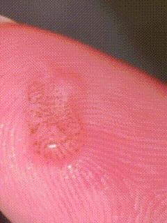 烧水壶里发现透明胶状物带黑点,是虫卵吗?摇蚊卵块科普(图1) 烧水壶里发现透明胶状物带黑点,是虫卵吗?摇蚊卵块科普(图1)
