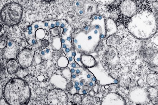 扎克伯格对人工智能帮助科学家治愈、预防或管理本世纪疾病持乐观态度(图1) 扎克伯格对人工智能帮助科学家治愈、预防或管理本世纪疾病持乐观态度(图1)