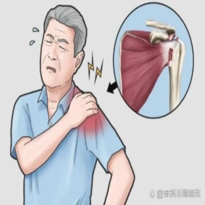 肩周炎别硬扛！不及时治会变慢性痛，影响生活