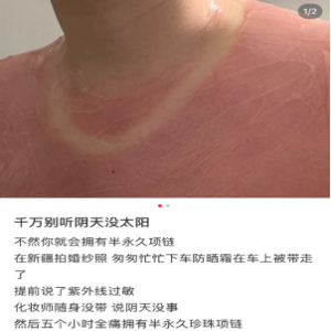 阴天不防晒更易晒伤？UVA穿透云层悄悄让你变黑