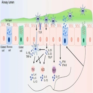 感冒咳出黄痰是快好了？别信，这其实是炎症加重的信号