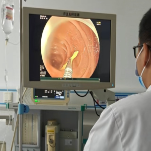 男子腹痛就医，十二指肠竟取出5厘米牙签