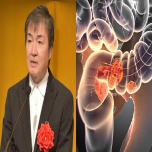 东野圭吾因肠癌去世，年轻人便血排便异常要当心