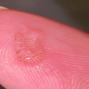 烧水壶里发现透明胶状物带黑点，是虫卵吗？摇蚊卵块科普